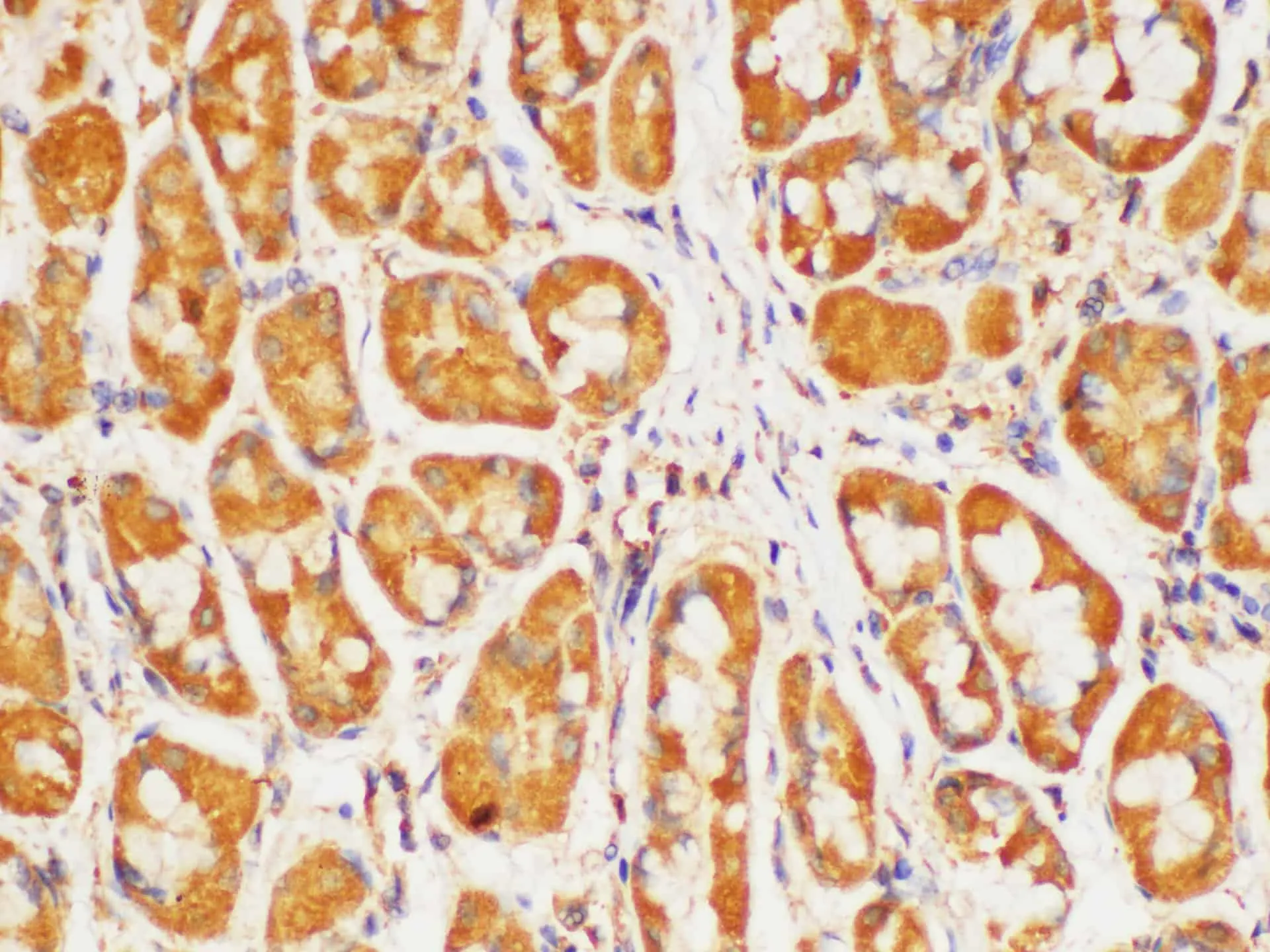 HRAS Polyclonal Antibody - image 3