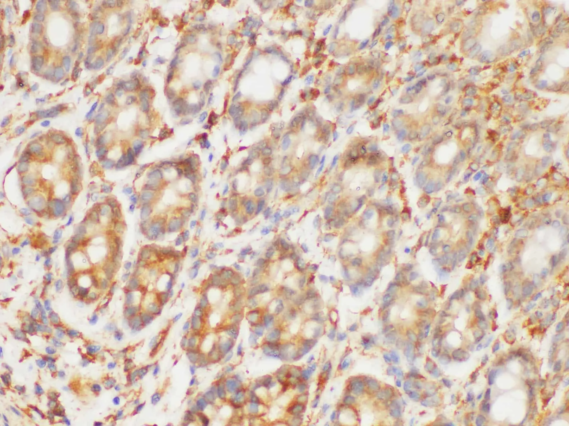 HRAS Polyclonal Antibody - image 5