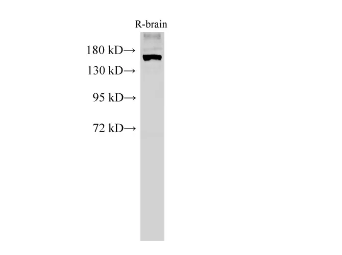 PARD3 Polyclonal Antibody - image 1