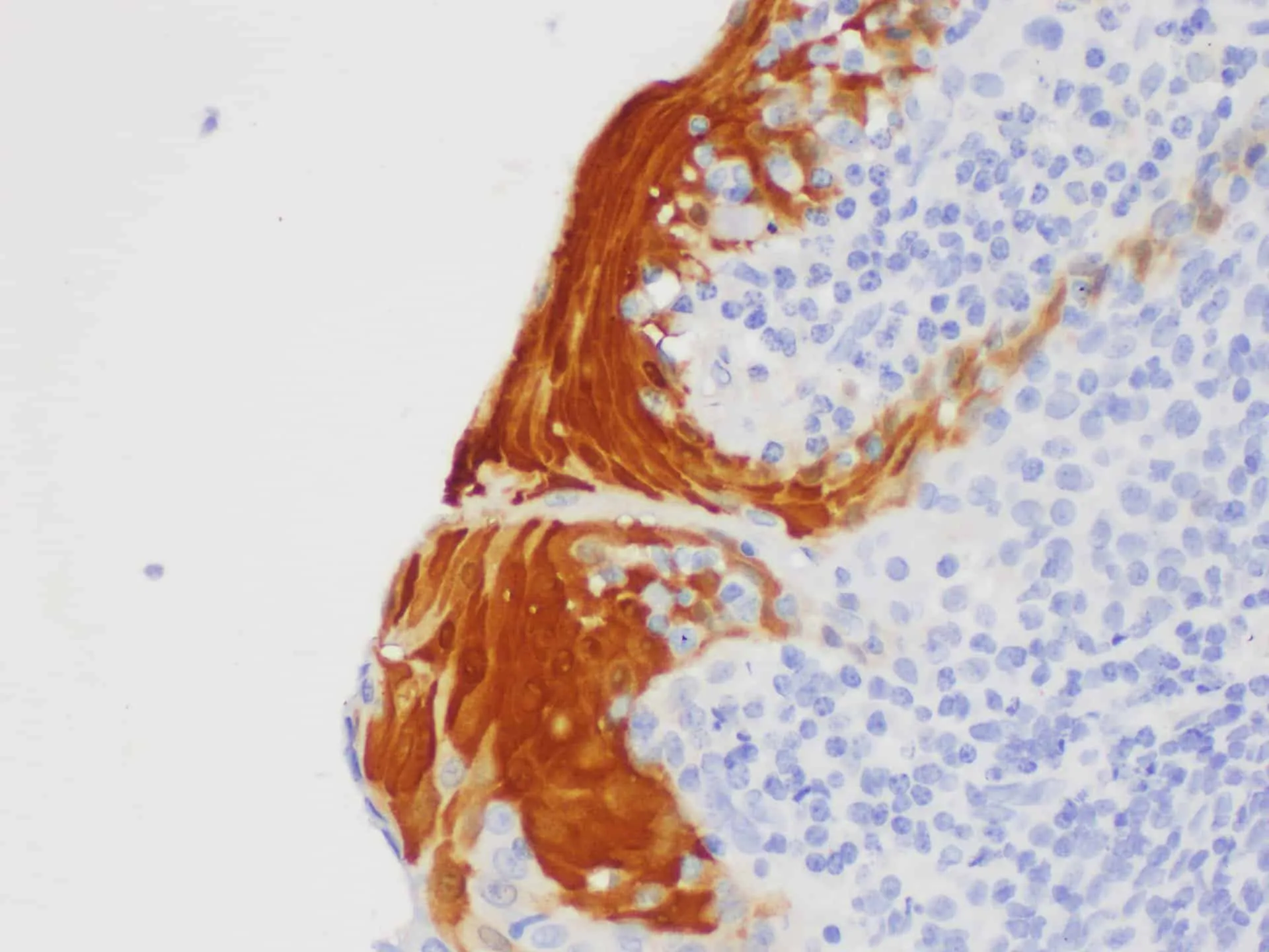 S100A7 Polyclonal Antibody - image 2