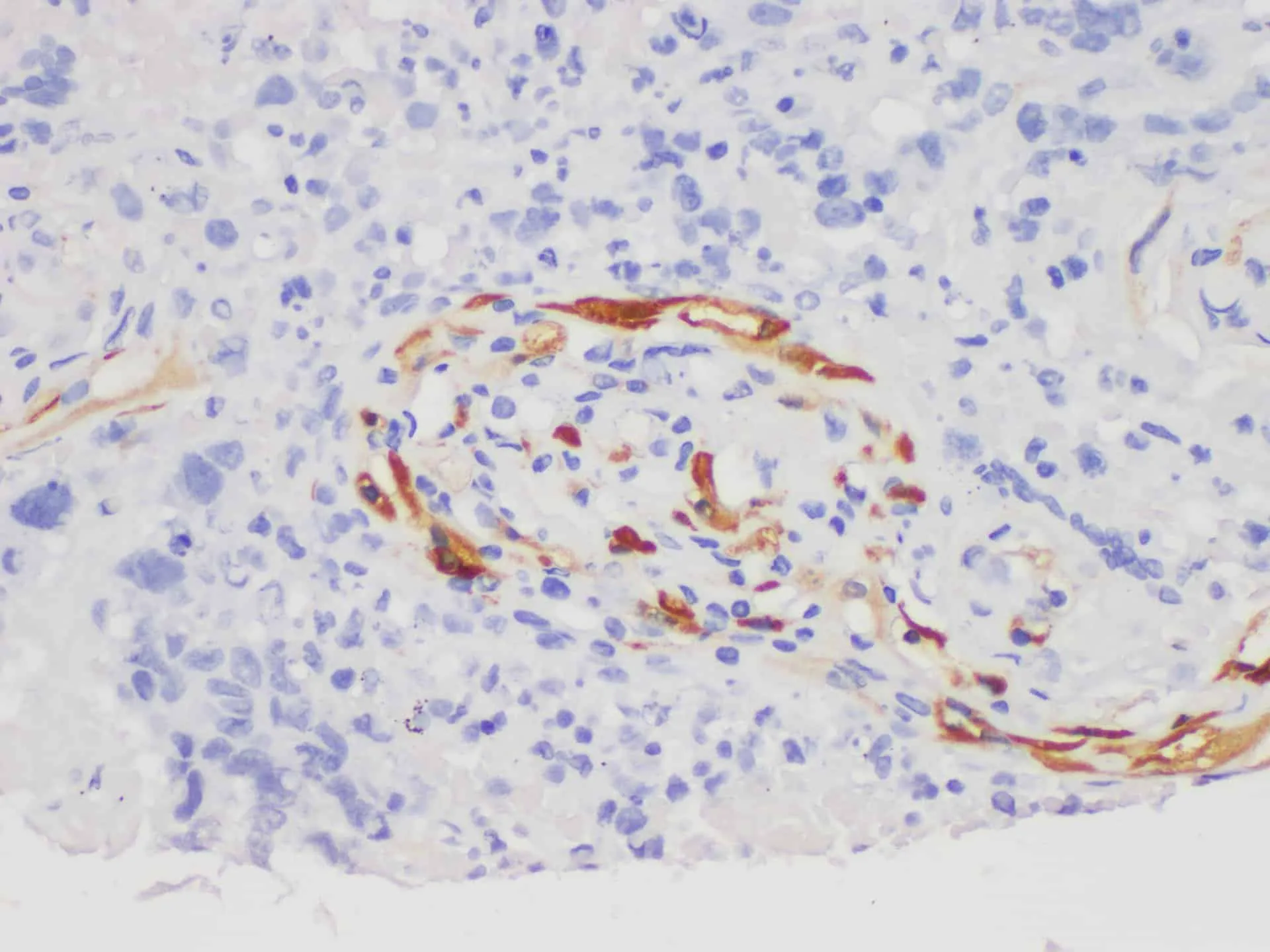 S100A7 Polyclonal Antibody - image 3