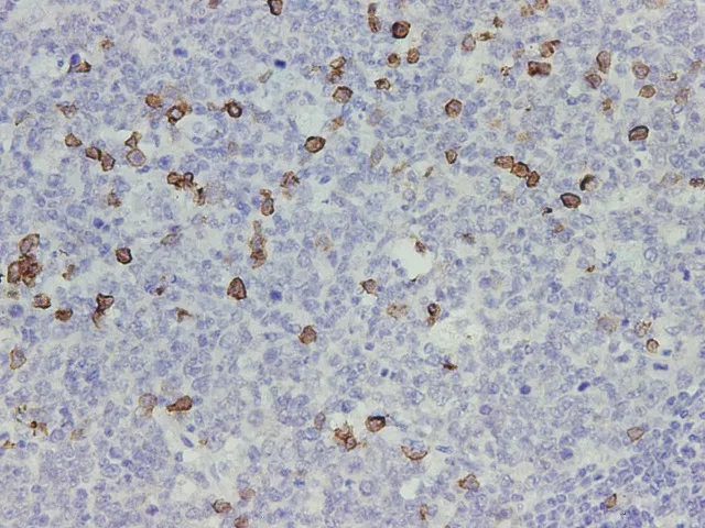 CD38 Polyclonal Antibody - image 2