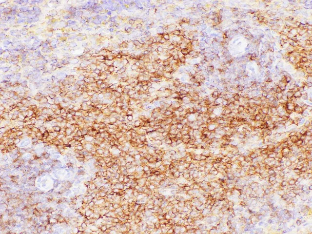 CD38 Polyclonal Antibody - image 3