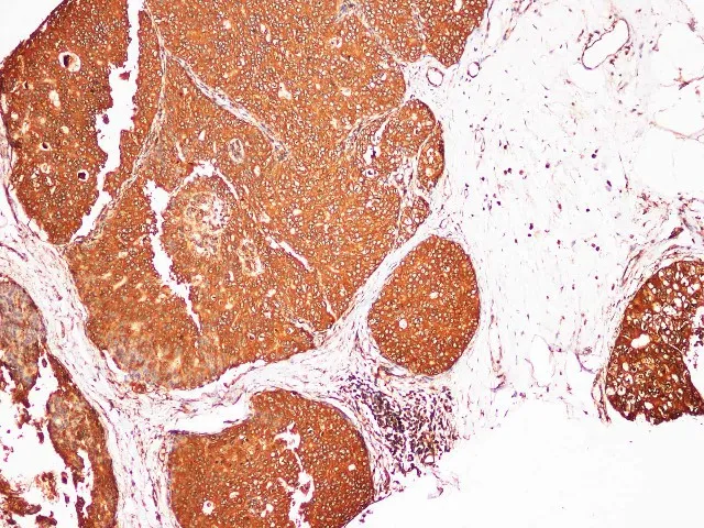S100A9 Polyclonal Antibody - image 1