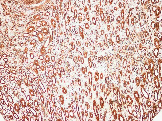 S100A9 Polyclonal Antibody - image 2