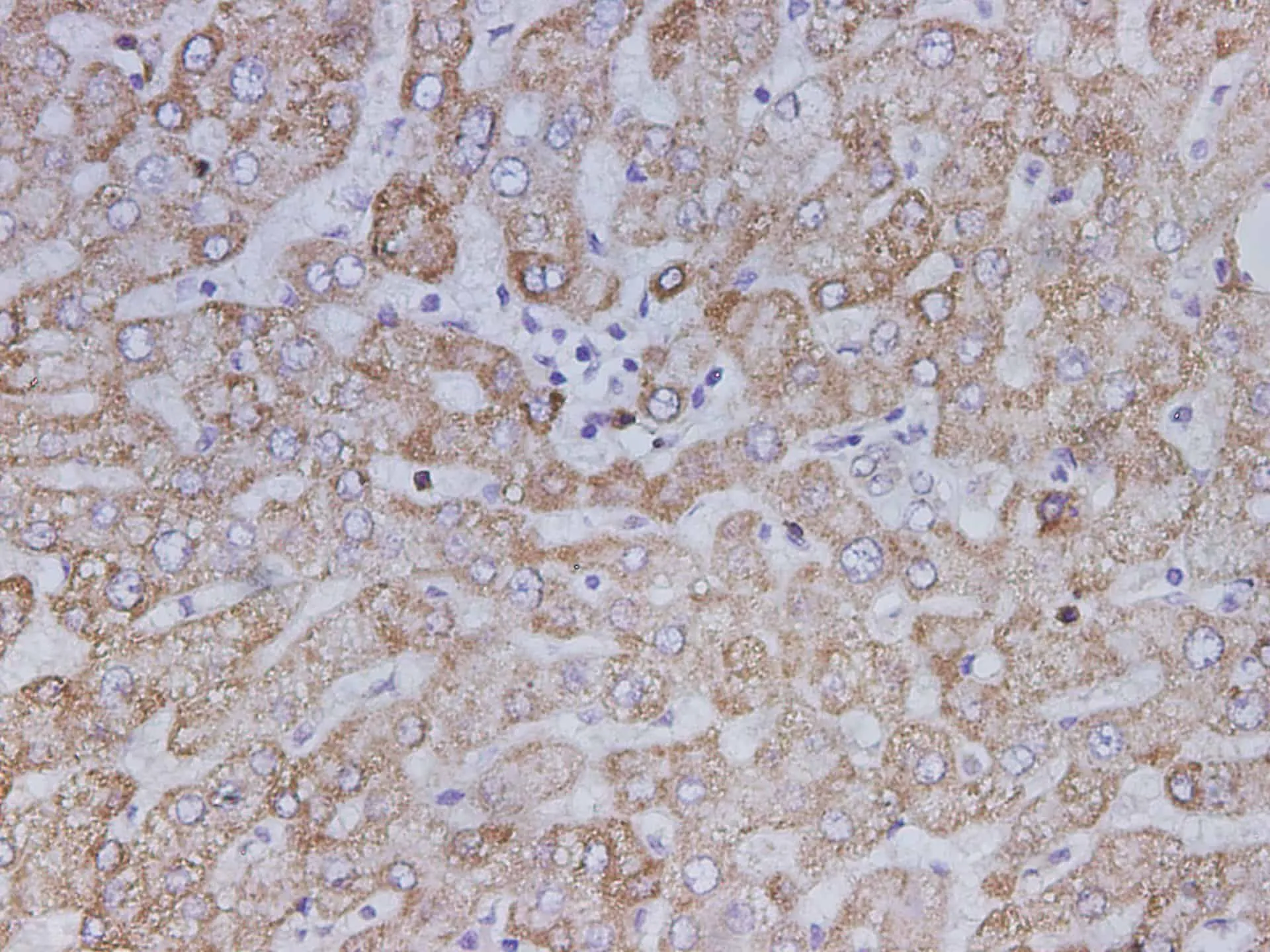 SDHB Polyclonal Antibody - image 1