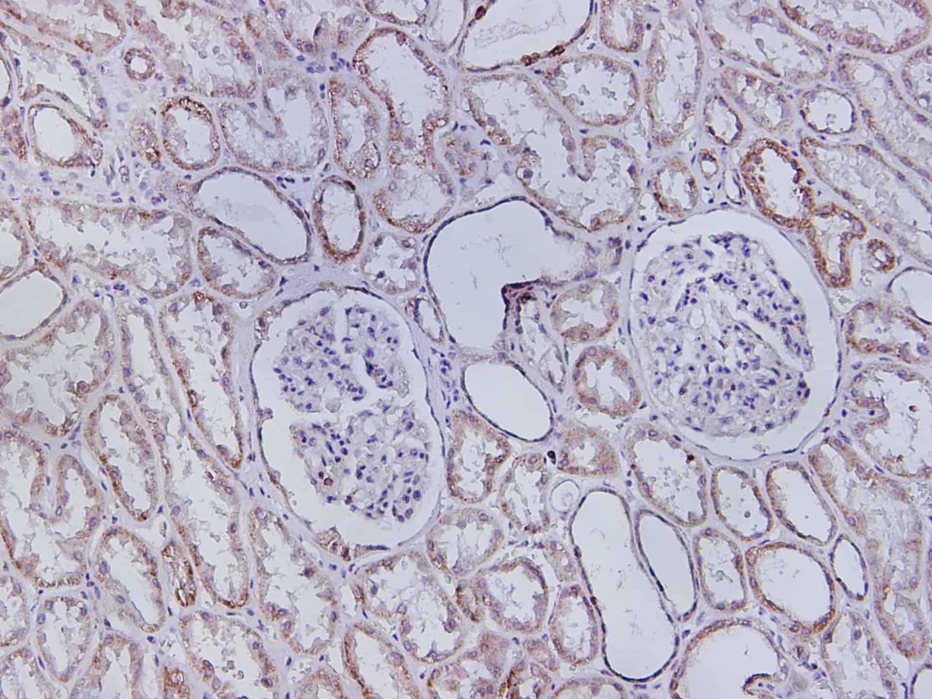 SDHB Polyclonal Antibody - image 2