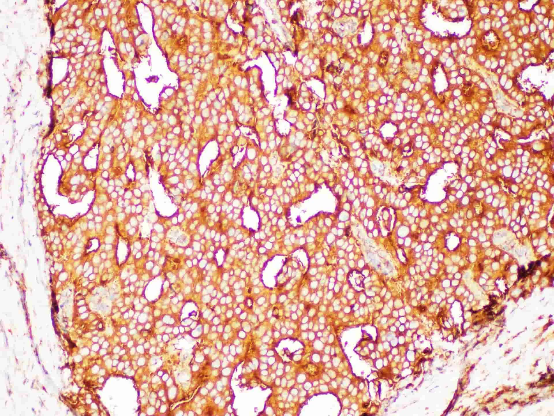 PSMA Polyclonal Antibody - image 2