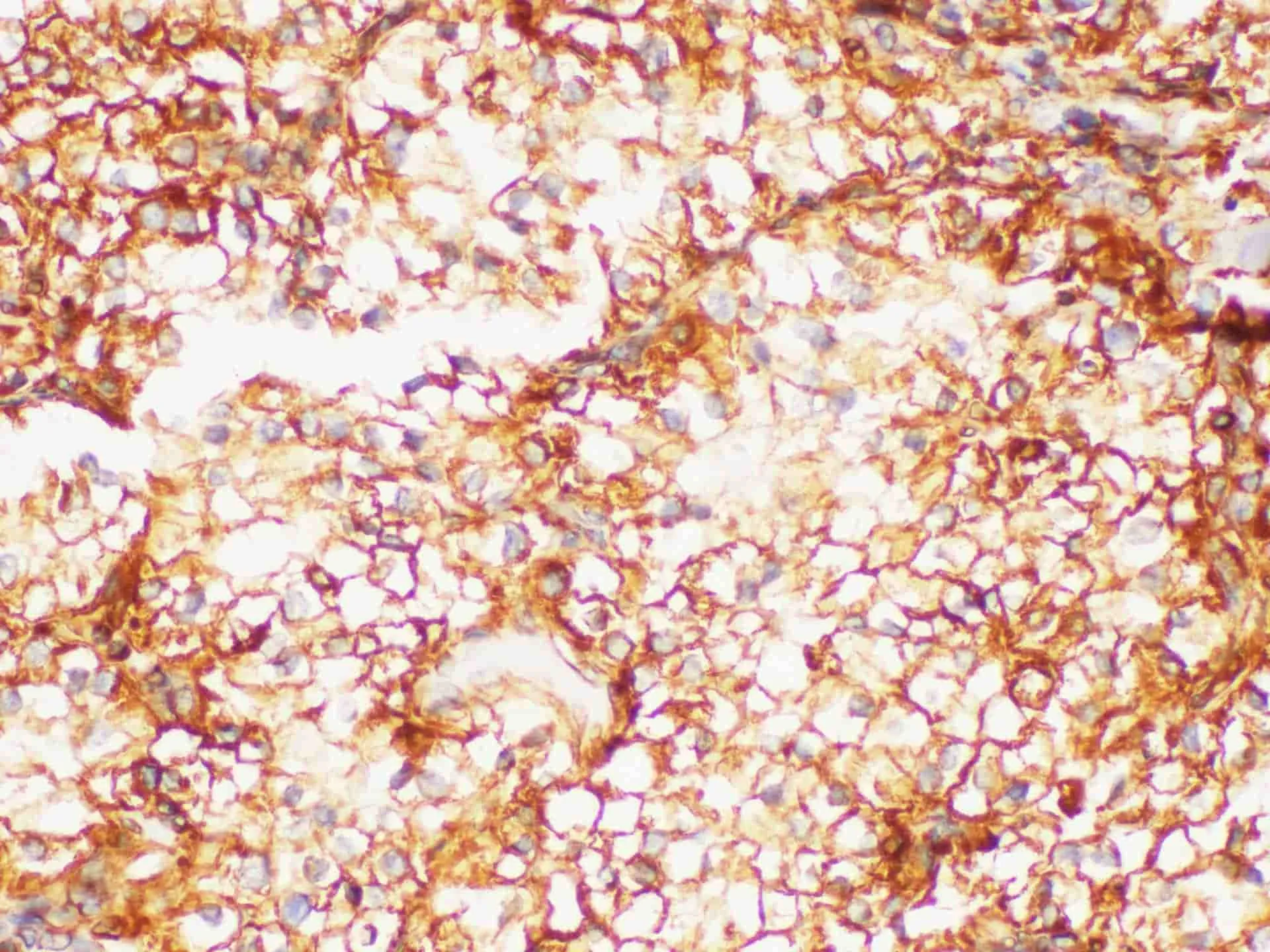 PSMA Polyclonal Antibody - image 3