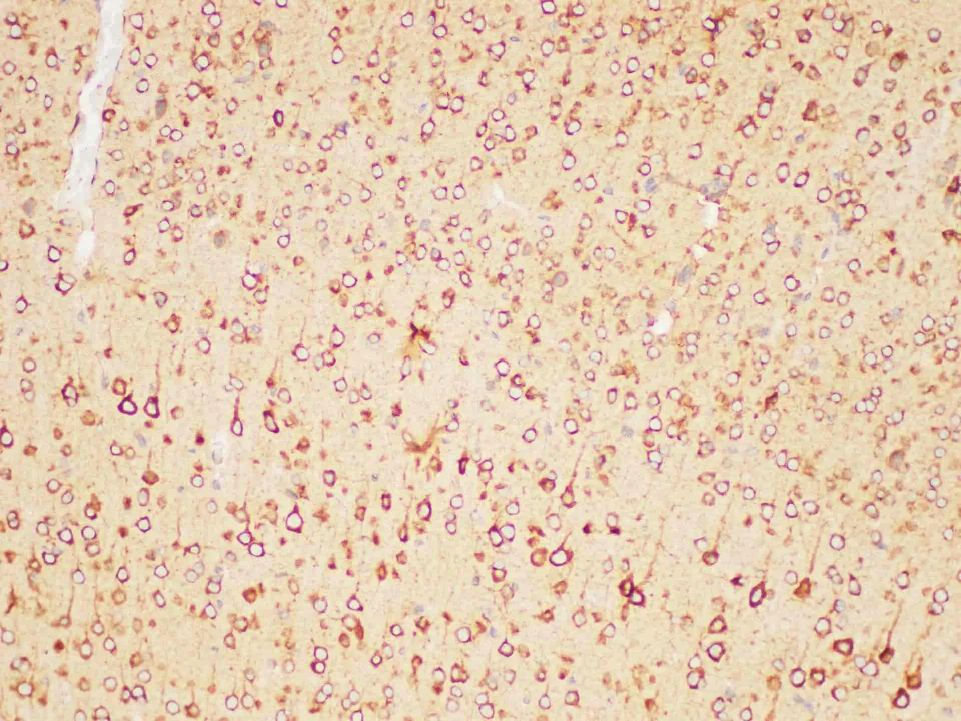 PSMA Polyclonal Antibody - image 4