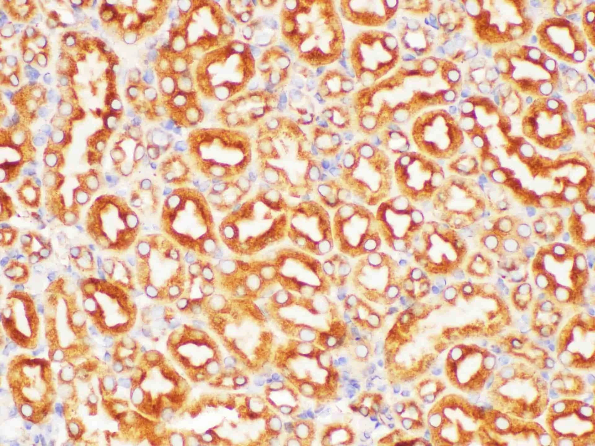 PSMA Polyclonal Antibody - image 5