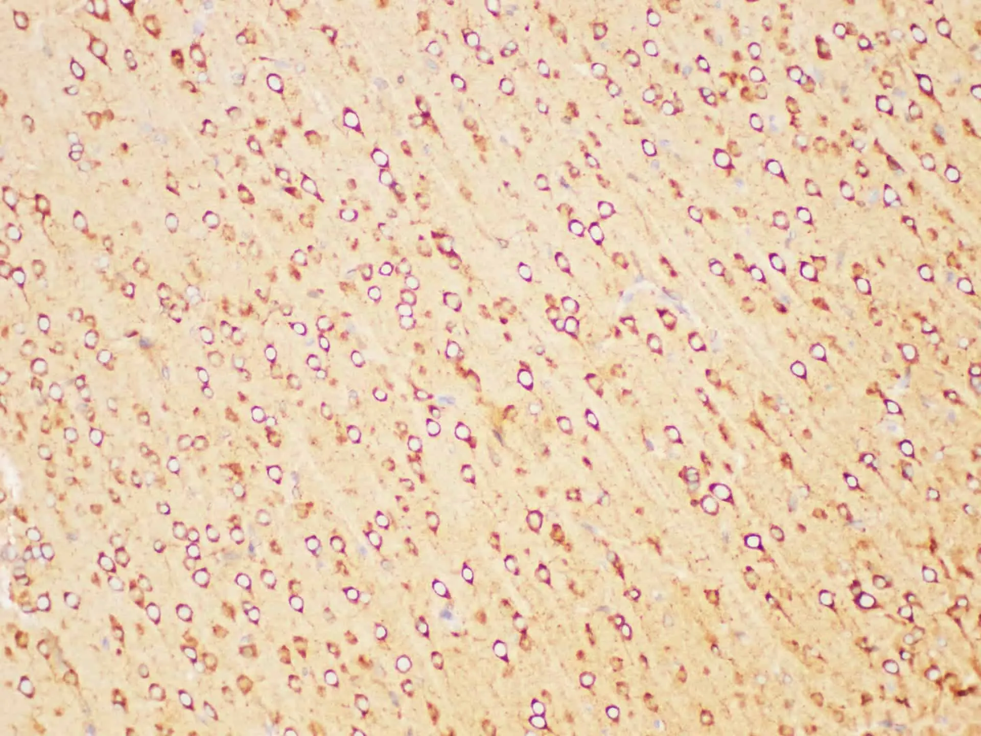 PSMA Polyclonal Antibody - image 6