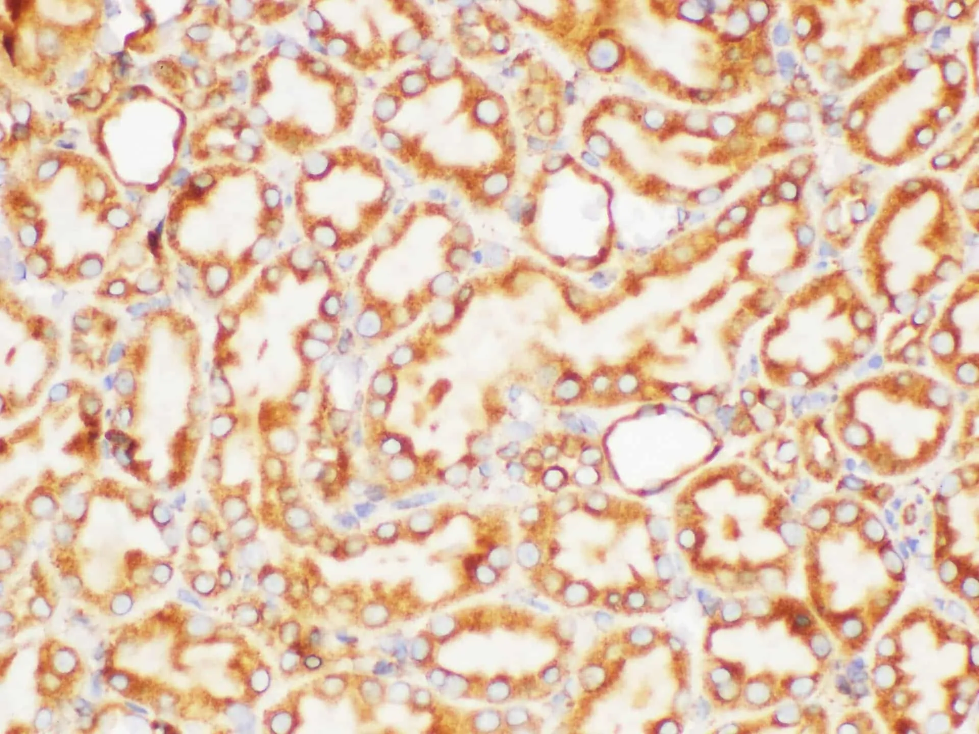 PSMA Polyclonal Antibody - image 7