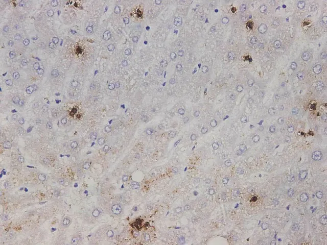 IL1A Polyclonal Antibody - image 1