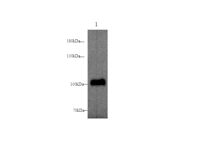 ST14 Polyclonal Antibody - image 1