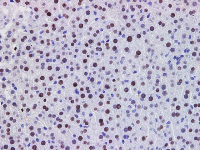 PDCD4 Polyclonal Antibody - image 4