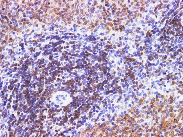 PDCD4 Polyclonal Antibody - image 5