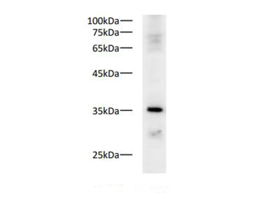 PCNA Polyclonal Antibody - image 1