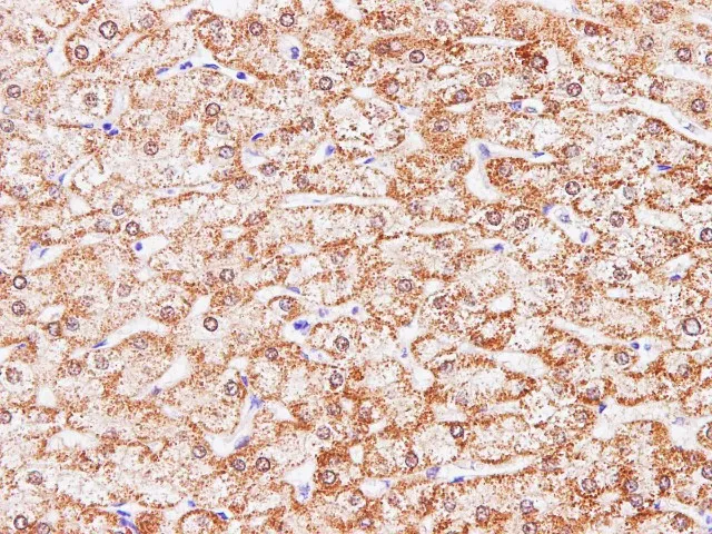 CCL2 Polyclonal Antibody - image 1