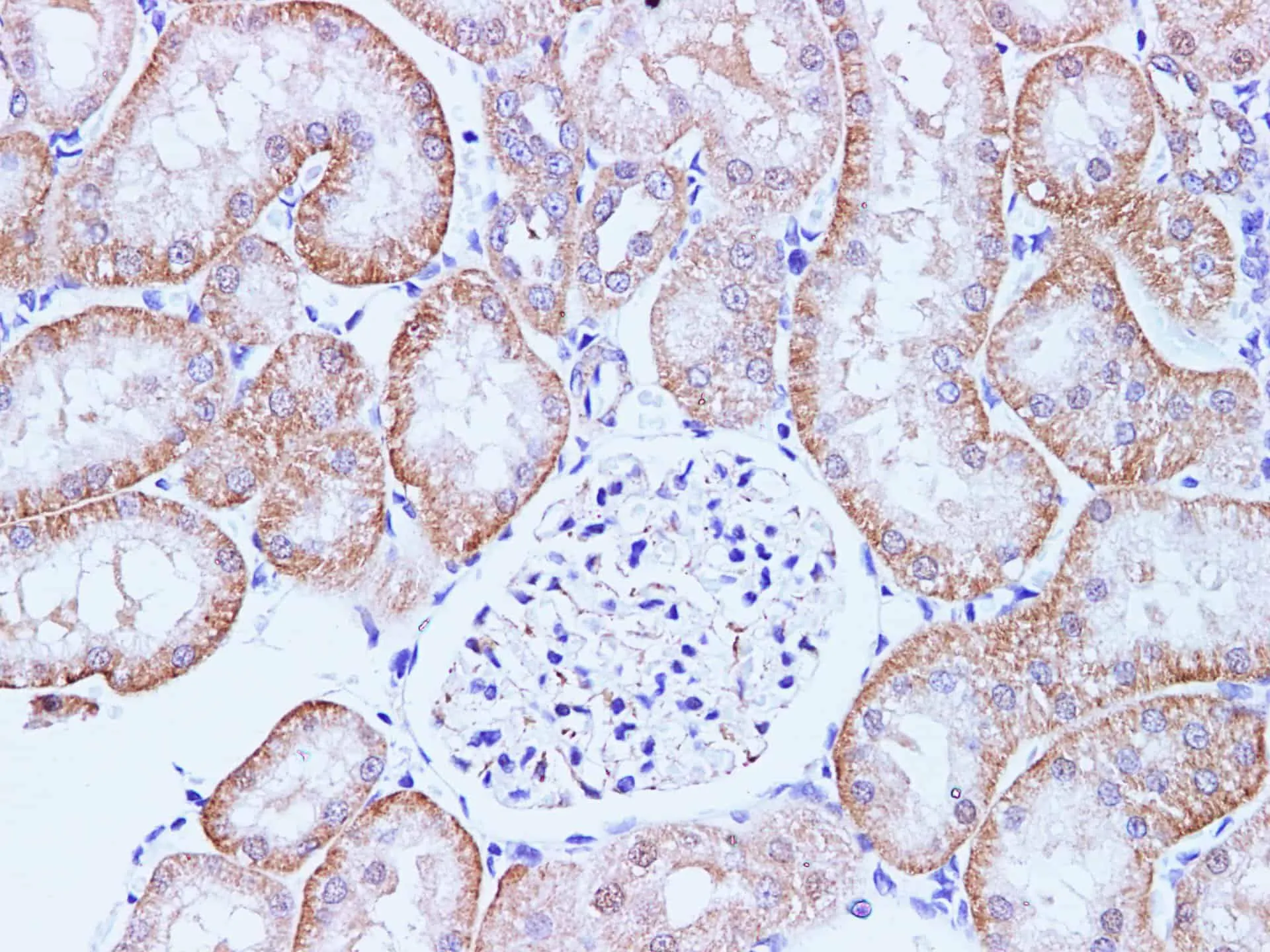 CCL2 Polyclonal Antibody - image 2
