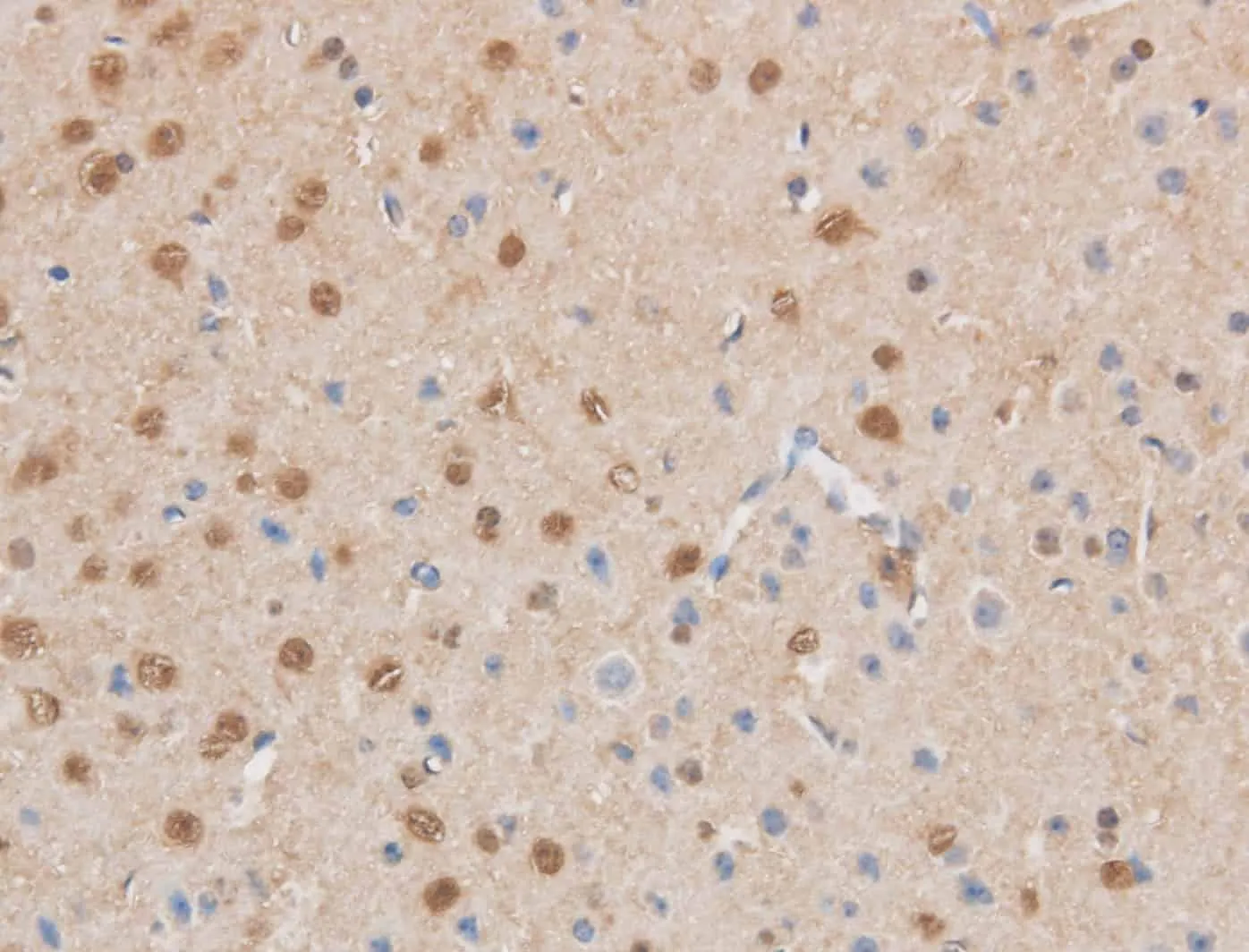 MAP2K6 Polyclonal Antibody - image 1