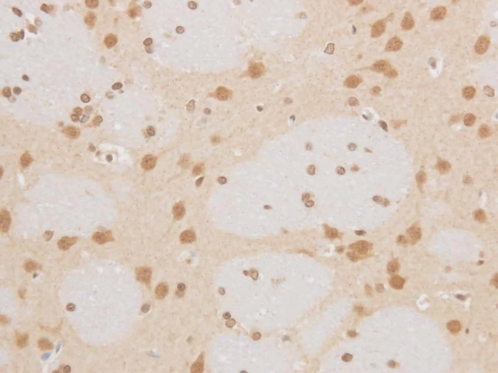 MAP2K6 Polyclonal Antibody - image 2