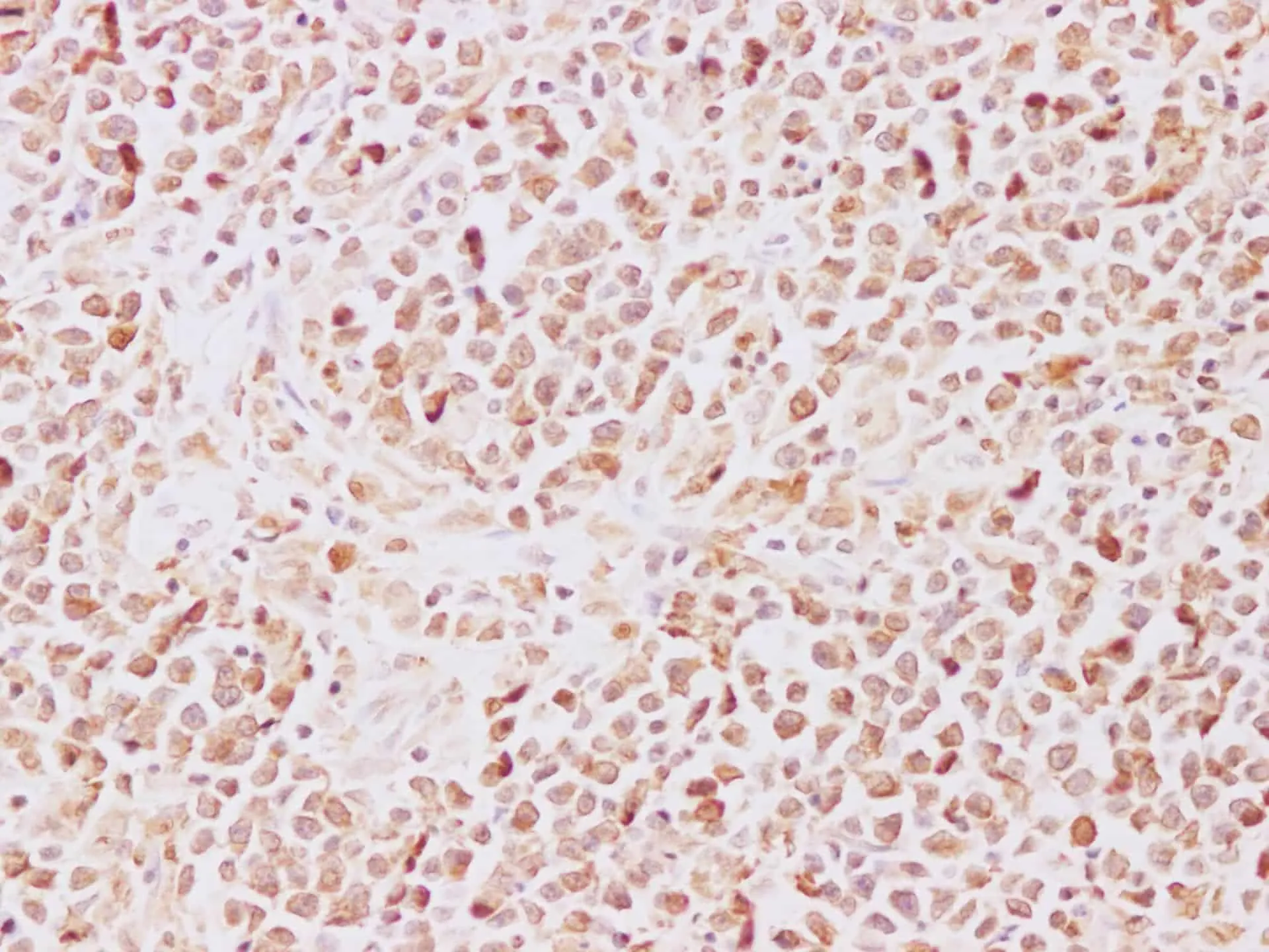 TRAF5 Polyclonal Antibody - image 2