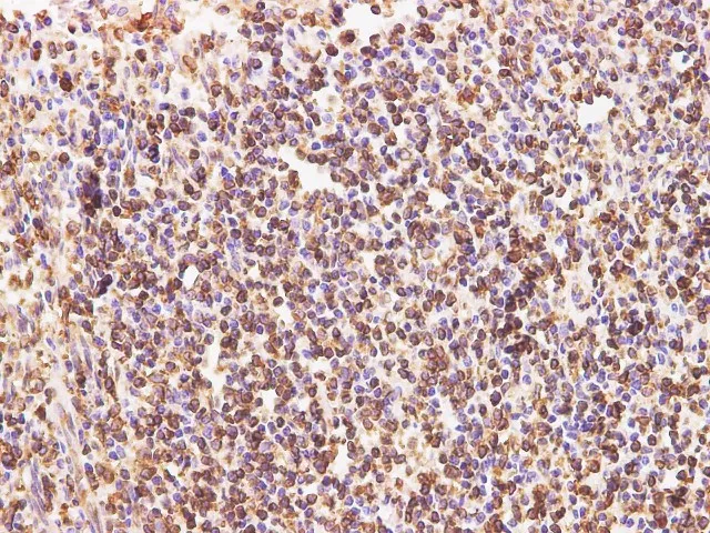 CD74 Polyclonal Antibody - image 2