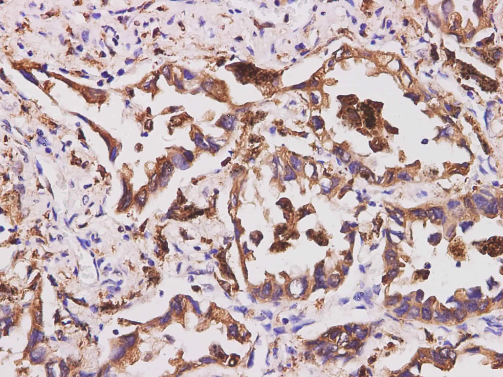 CD74 Polyclonal Antibody - image 3