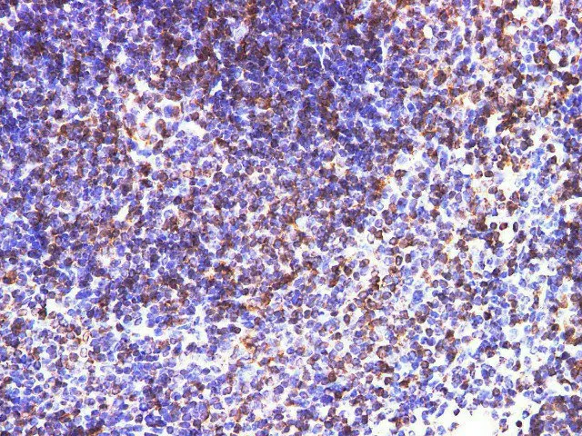 CD74 Polyclonal Antibody - image 4