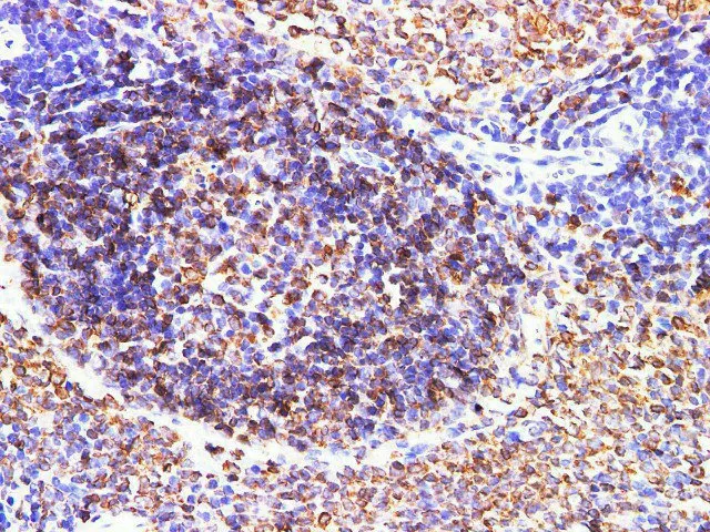 CD74 Polyclonal Antibody - image 5