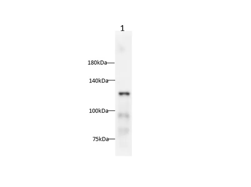 E-Cadherin Polyclonal Antibody - image 1
