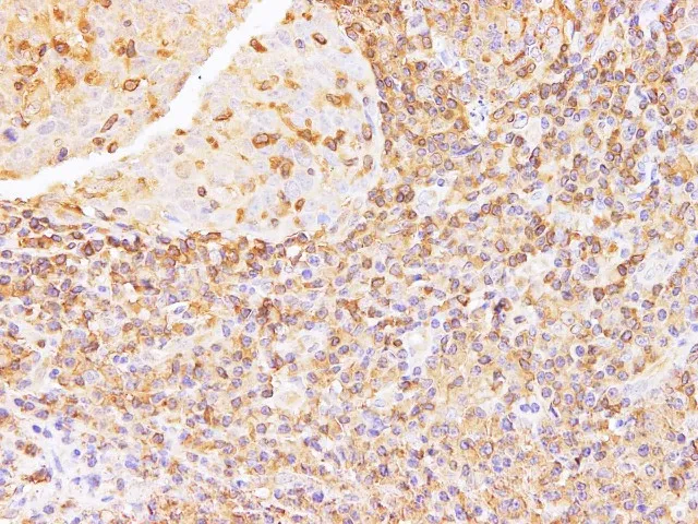ANXA6 Polyclonal Antibody - image 3