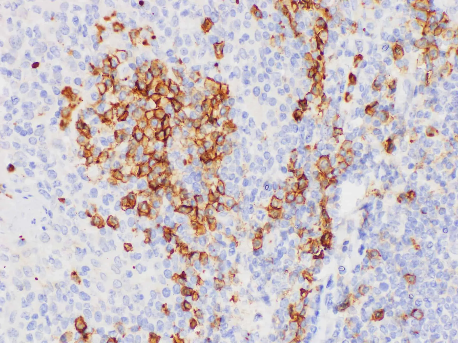 CD38 Polyclonal Antibody - image 1