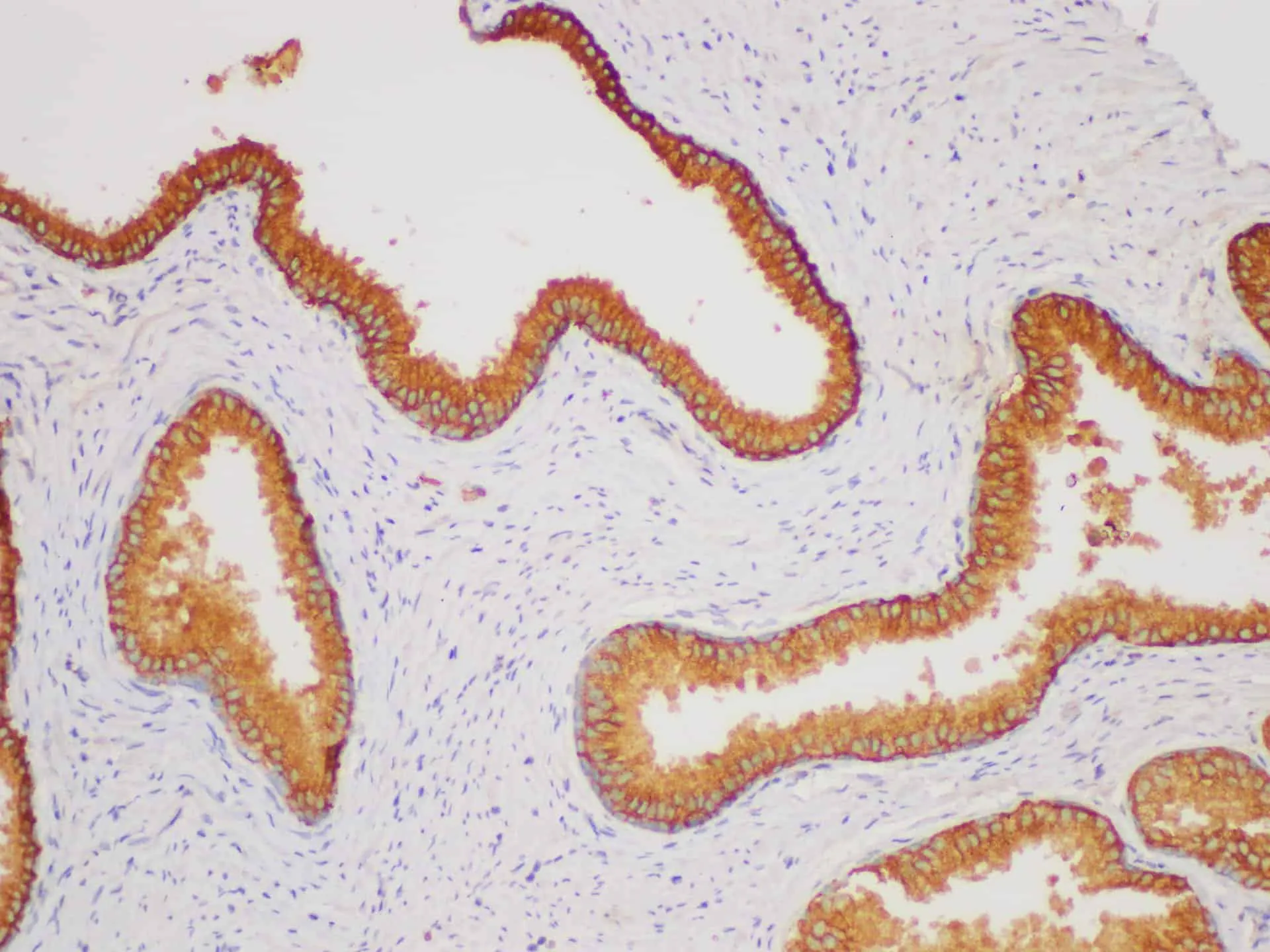 CD38 Polyclonal Antibody - image 2