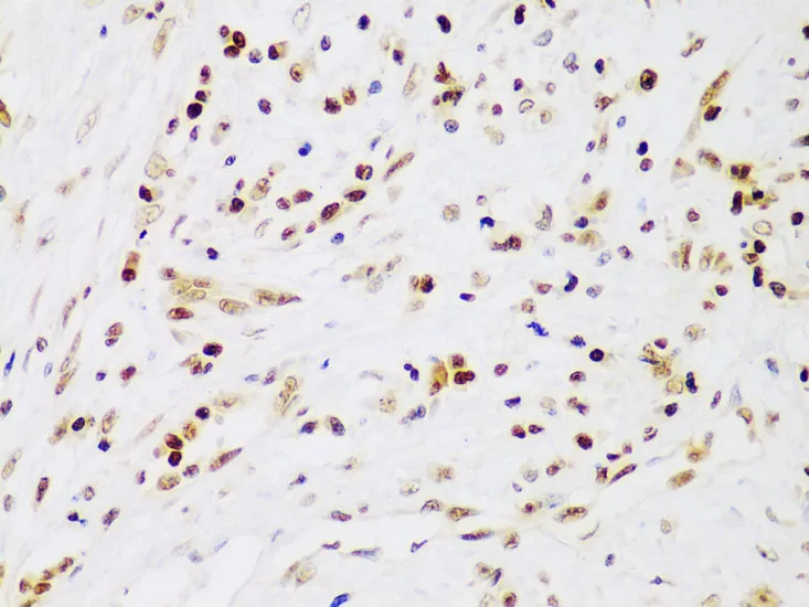 IKK beta Polyclonal Antibody - image 2