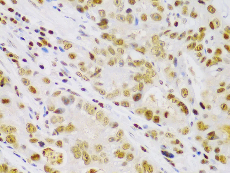 IKK beta Polyclonal Antibody - image 3