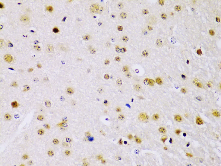 IKK beta Polyclonal Antibody - image 4