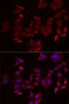 NPHP1 Polyclonal Antibody - image 2