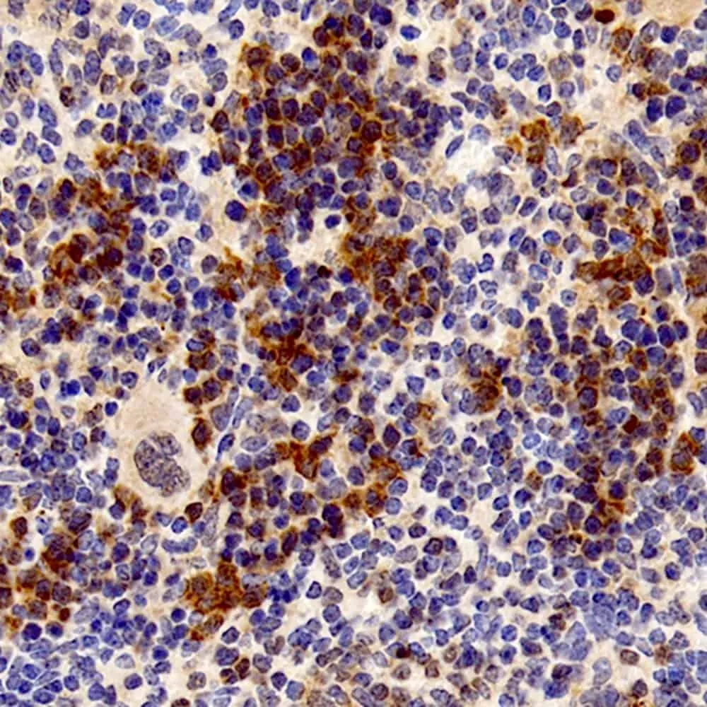 UCP2 Polyclonal Antibody - image 1