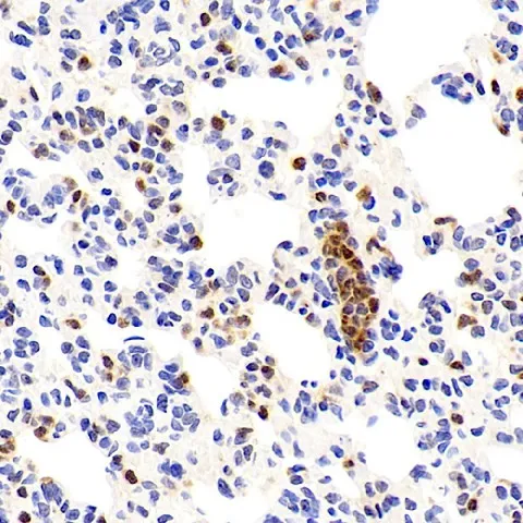 UCP2 Polyclonal Antibody - image 2