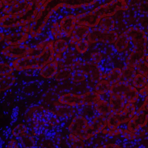 BECN1 Polyclonal Antibody - image 1