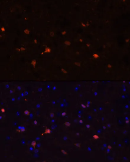 S100B Polyclonal Antibody - image 1