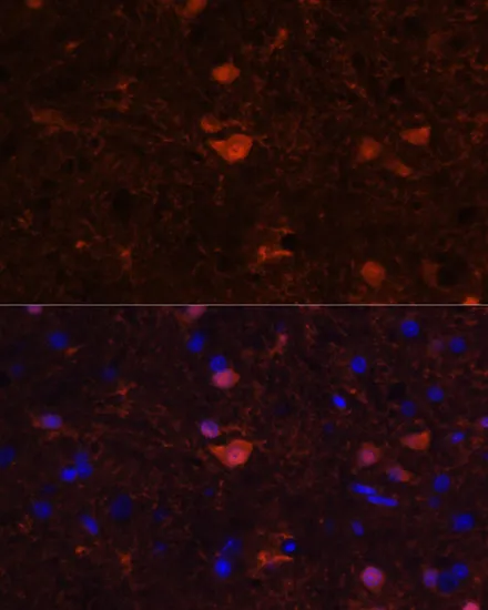 S100B Polyclonal Antibody - image 2