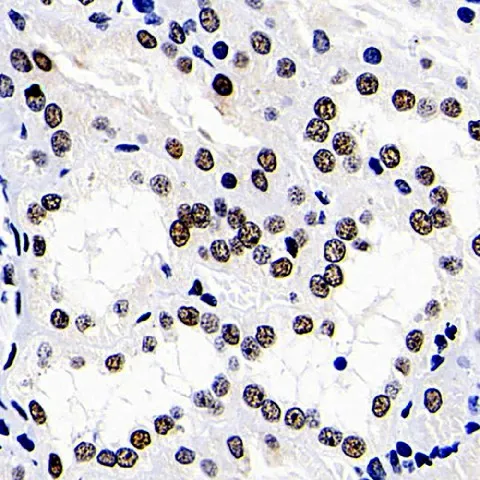 DNMT1 Polyclonal Antibody - image 1