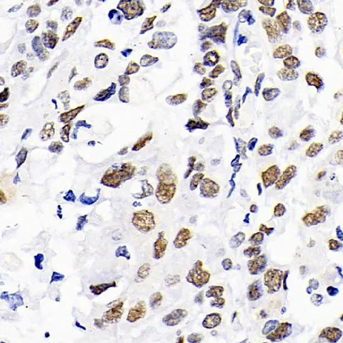 DNMT1 Polyclonal Antibody - image 2
