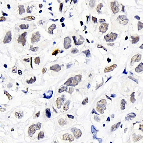 DNMT1 Polyclonal Antibody - image 3