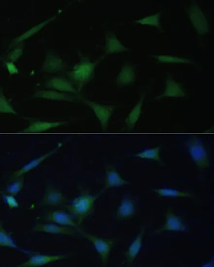P38 MAPK Polyclonal Antibody - image 1