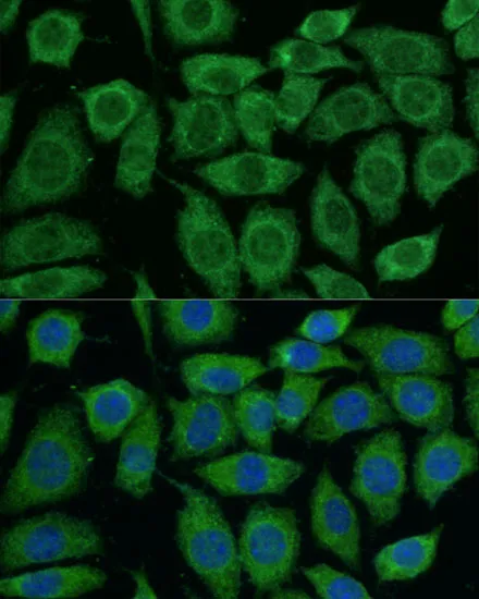 DLAT Polyclonal Antibody - image 4
