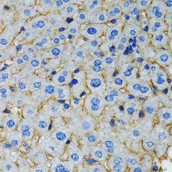 RAF1 Polyclonal Antibody - image 1
